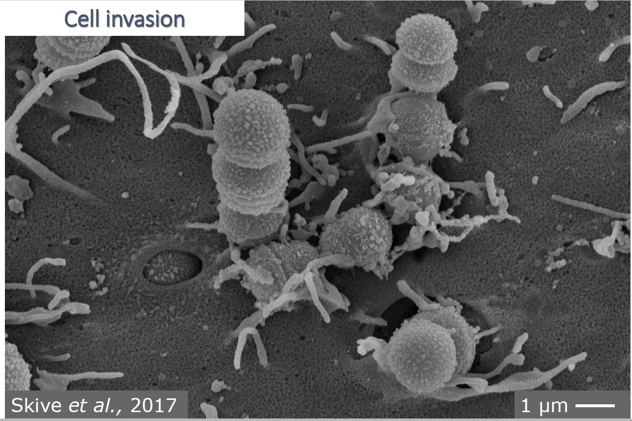 Invasion cellulaire de streptocoques vue au microscope